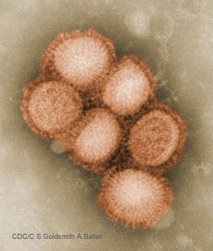 H1N1 influenza virus
