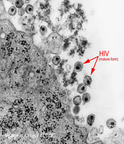 HIV in tissue sample
